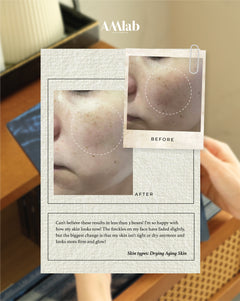 AMlab Hydra-Lift Water Bomb Mask (3x30ml)